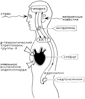 вплив стресу на розвиток ревмокардиту