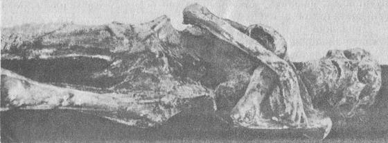 труп у стані природної муміфікації