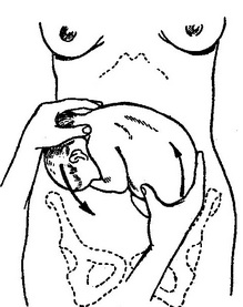 операція повороту плода зовнішніми прийомами при поперечному положенні