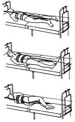 міжхребцевий остеохондроз накроватним витягування