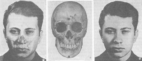 фотосовмещение ідентифікації особи за черепом