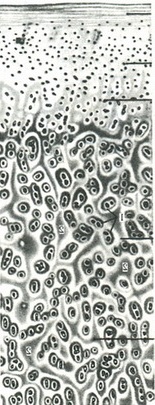 будова суглобового хряща