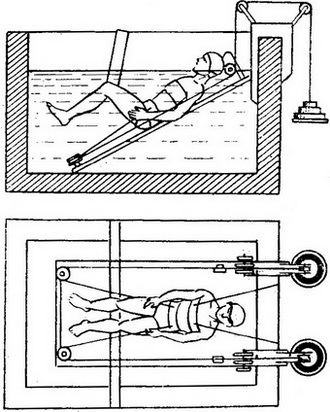 міжхребцевий остеохондроз підводне витягування