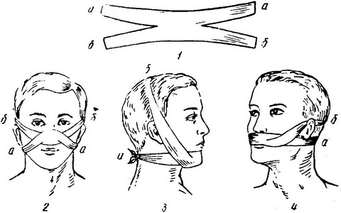 пращевидные пов'язки