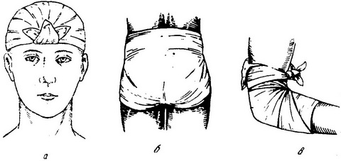 косыночные пов'язки