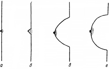 розвиток молочних залоз в період статевого дозрівання