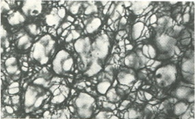 ретикулярні волокна печінки