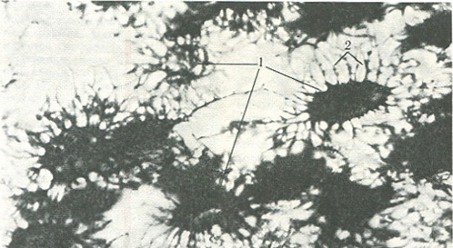 кісткова тканина