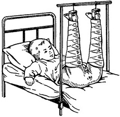 положення по Шеде