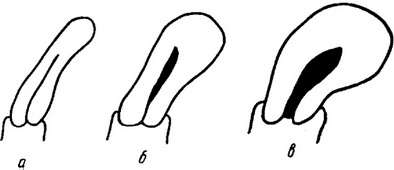 форма і розміри матки