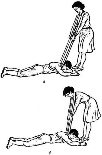 штучне дихання за способом Каллистова