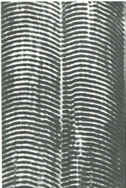 поперечносмугасті м'язові волокна