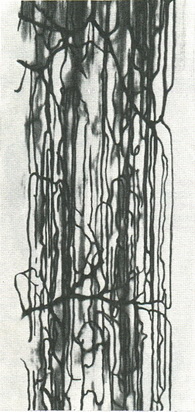 кровоносні капіляри м'язи