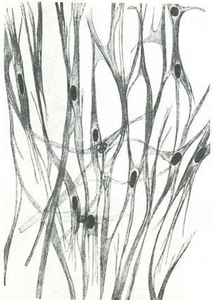 гладкі м'язові волокна ендокарда