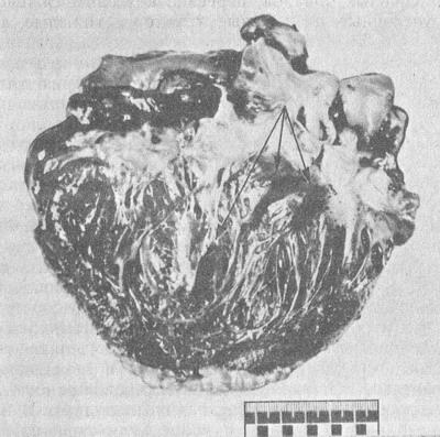 плями Мінакова
