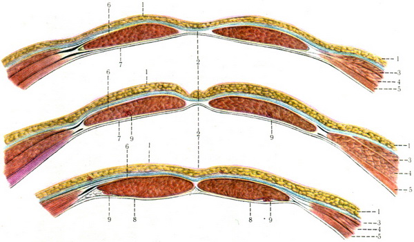 піхва передньої стінки живота