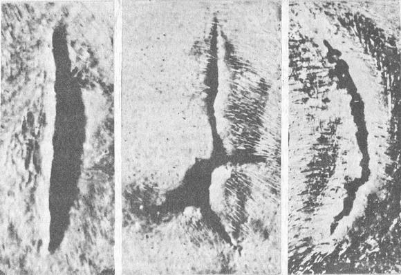 види забитих ран