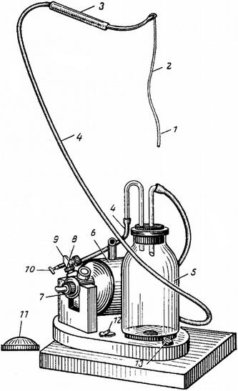 загальний вигляд системи для вакуум-екстракції катаракти