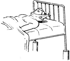 витягування петлею Глиссона