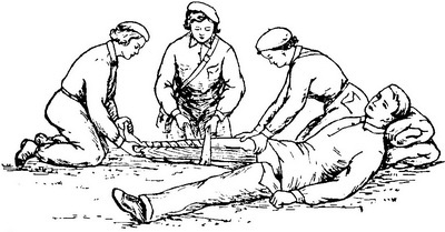 накладання шини при переломі