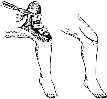 дослідження ядер Бекляра