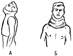 гіпсовий полукорсет і гіпсовий нашийник