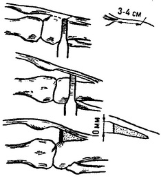 операція Банді в модифікації Шойлева