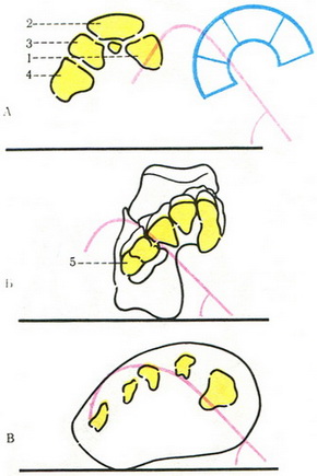 поперечні склепіння стопи на різних її рівнях