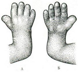 розвиток кисті ембріона