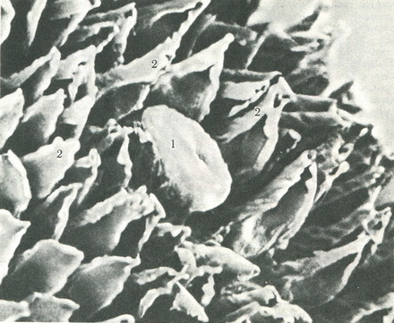 форма сосочків язика