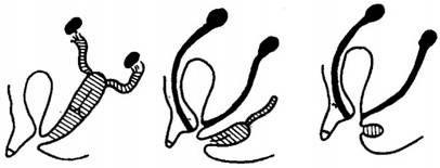 форми чоловічого псевдогермафродитизма