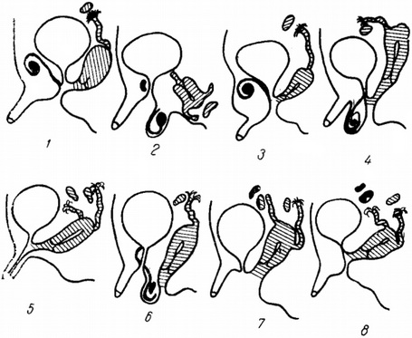 форми справжнього гермафродитизму