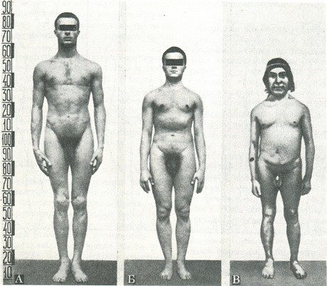 типи конституції людини