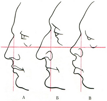індивідуальні особливості профілів носа і особи