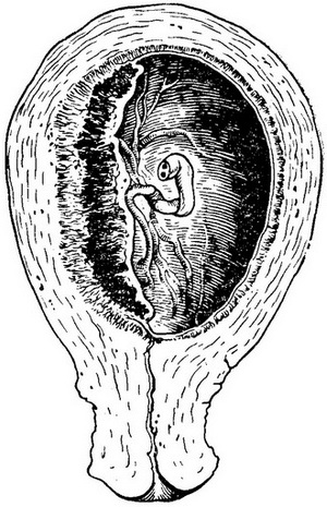 дитяче місце в матці