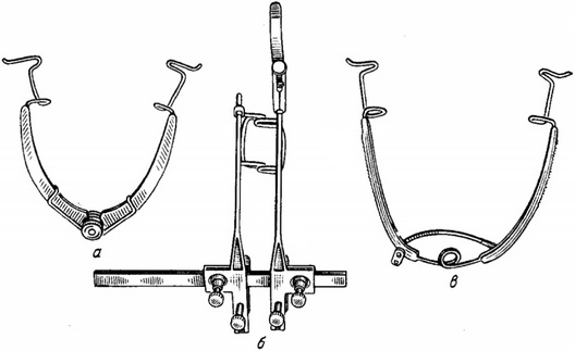 блефаростаты