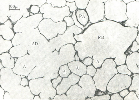 гістологічний зріз паренхіми легені