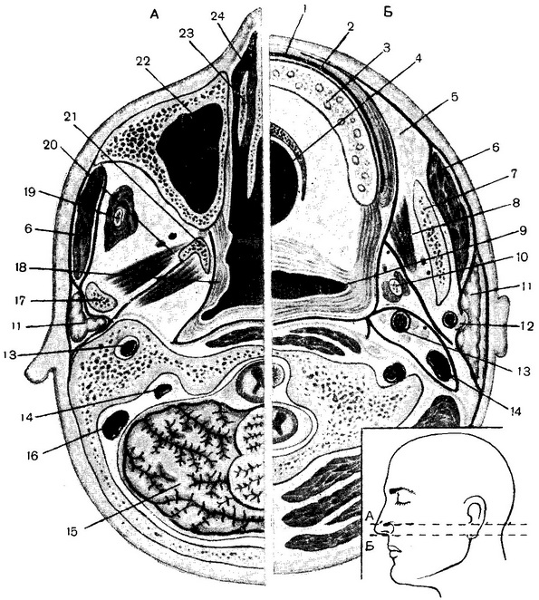 фасції особи горизонтальні розпили