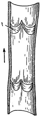 відень у поздовжньому розрізі