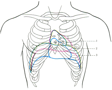 топографія серця