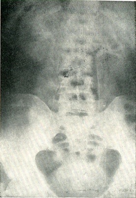 видільна урограмма