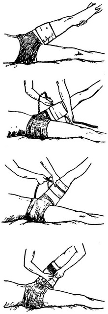 послідовність накладання гумового джгута в картинках