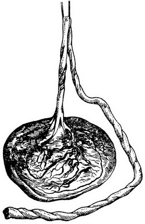 дитяче місце з пуповиною