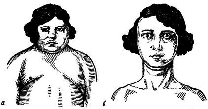 порушення функцій щитовидної залози