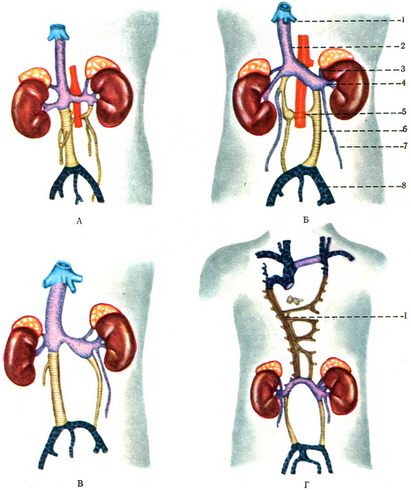 схема найбільш часто зустрічаються аномалій вен