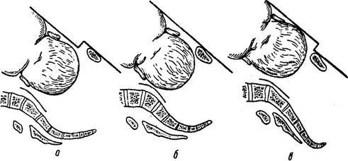 зображення прийому Васта