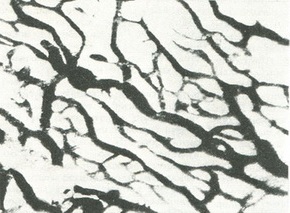 мережа лімфатичних капілярів парієтальної очеревини