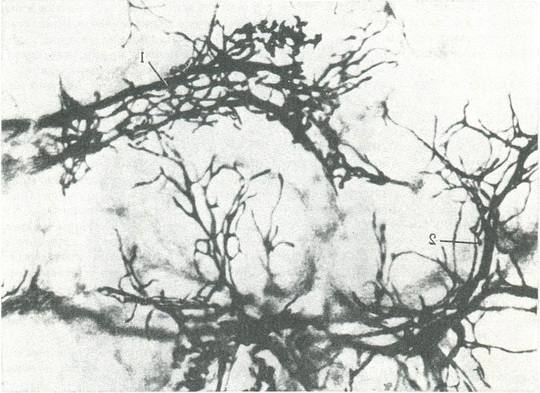 лімфатичні судини печінки