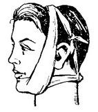 пращевидная пов'язка на підборіддя