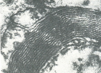 знімок мієлінової оболонки